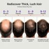 🔥 Power Red Light Therapy Cap🔥 | Reverse Thinning Hair Completely Infrared Hair Growth Cap
