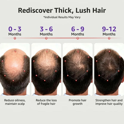 🔥 Power Red Light Therapy Cap🔥 | Reverse Thinning Hair Completely Infrared Hair Growth Cap
