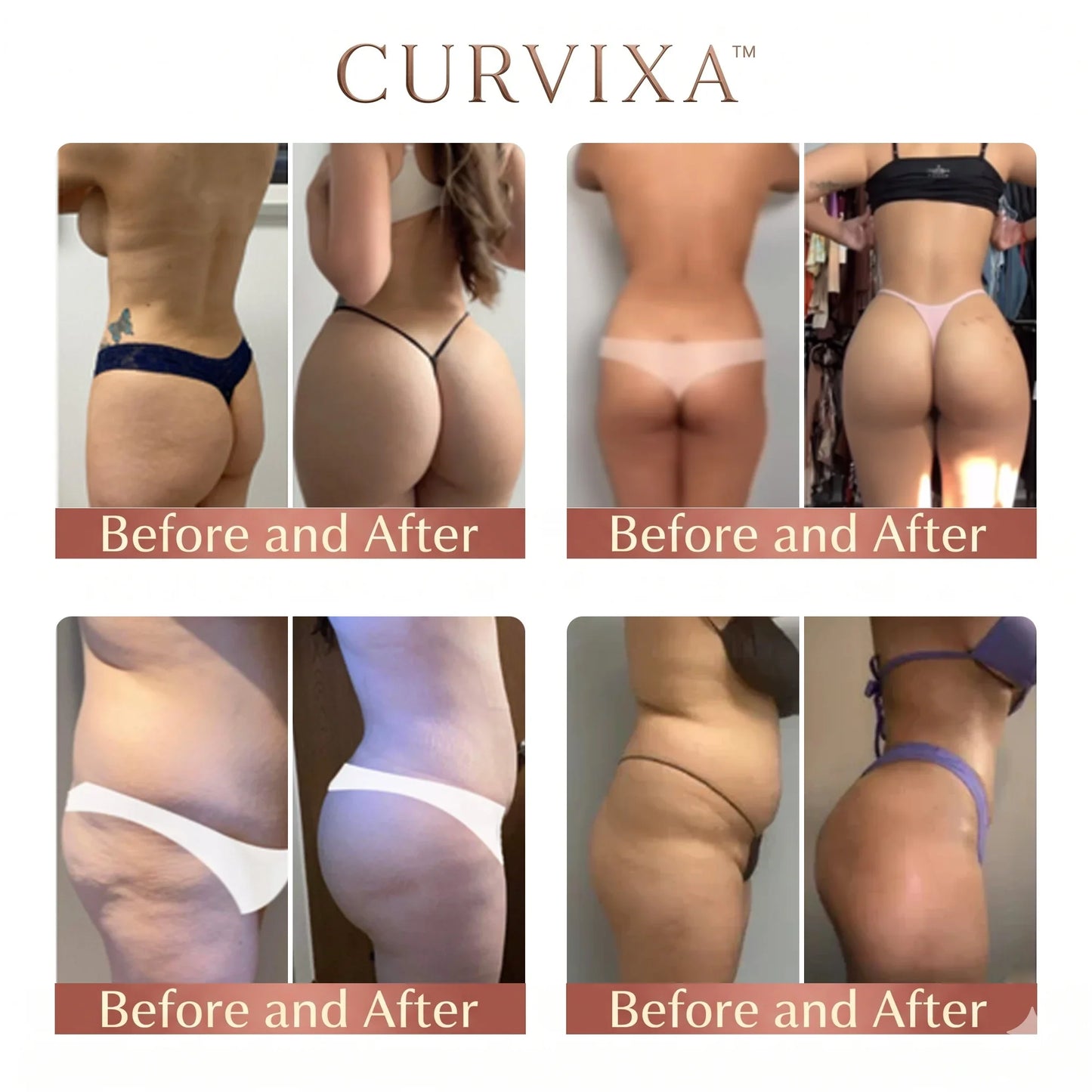 CurveSculpt Micro-Patch ✦ Sculpt • Firm • Smooth Lower Body Curves ✦ Micro-Needle Infusion System