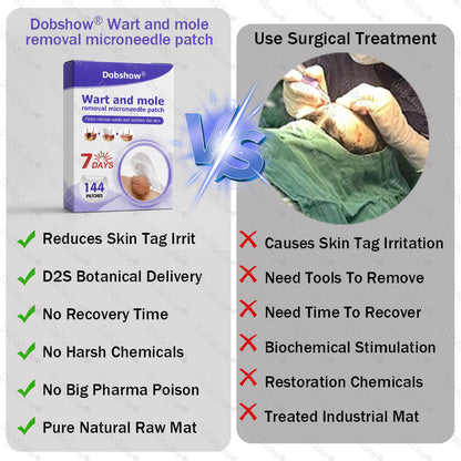 🏅𝙏𝙂𝘼 𝘼𝙥𝙥𝙧𝙤𝙫𝙚𝙙 | Dobshow® Wart and mole removal microneedle patch