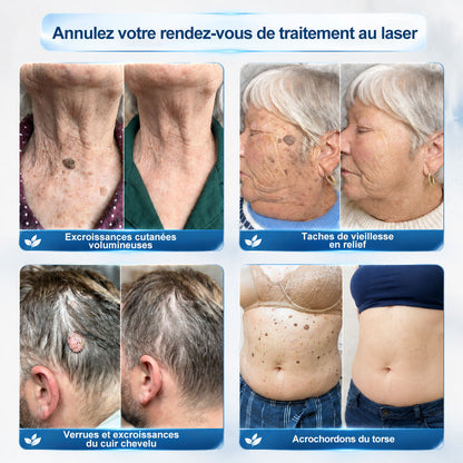 Boutique officielle de la marque (Belgique) |✏️𝐏i𝐜𝐝o® 7 Jours Effaceur de taches et d’excroissances cutanées(Zéro douleur, zéro cicatrice – Roller)