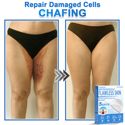 ⭐Celsiora® 2-in-1 Microneedle & Hydrocolloid Patch | Raised Moles,Acne,  Flat Warts & Skin Tags Remover | Improves Wrinkles, Scars & Blemishes | Invisible Star Pimple Patches for Face & Body
