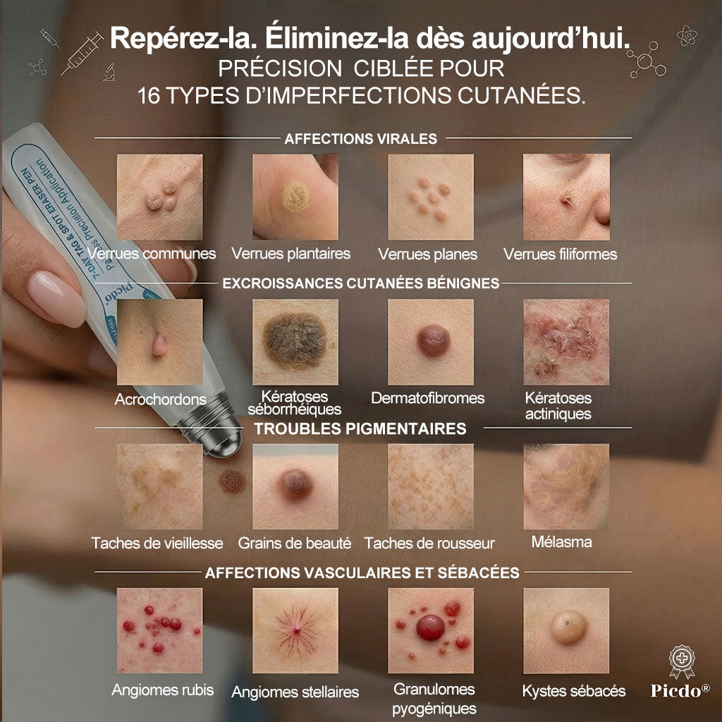 Boutique officielle de la marque (Belgique) |✏️𝐏i𝐜𝐝o® 7 Jours Effaceur de taches et d’excroissances cutanées(Zéro douleur, zéro cicatrice – Roller)