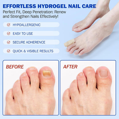 Onychomycosis stickers