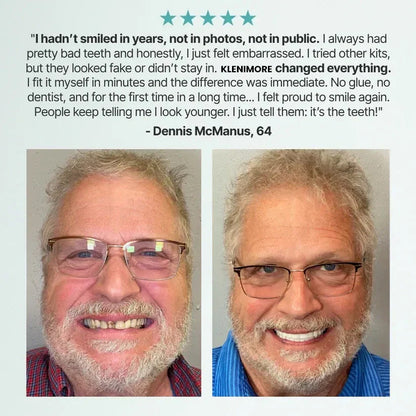 🎅CHRISTMAS HOT SALE-🏆Ends Today: 70% OFF! 🦷 Custom-Fit Dentures That Let You Eat, Talk & Smile With Confidence